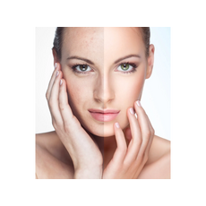 DR.PEN M8, image , 8 image