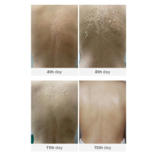 Medisco Peelieve Peeling 1X1g+1X8ml, image , 3 image
