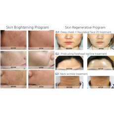 Syna Plus Injector, image , 7 image