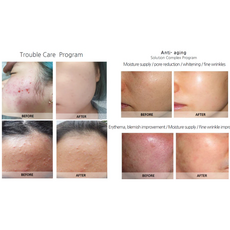 Syna Plus Injector, image , 8 image