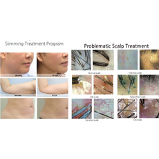 Syna Plus Injector, image , 9 image