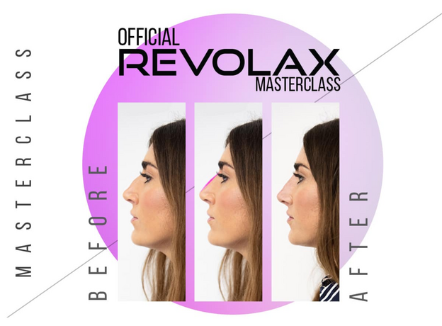 Revolax SUB-Q Lidocaine Acid Hialuronic, image , 3 image