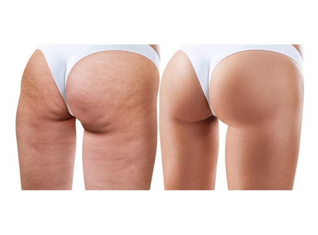 Medistabyl Forte Acid Hialuronic, image , 3 image