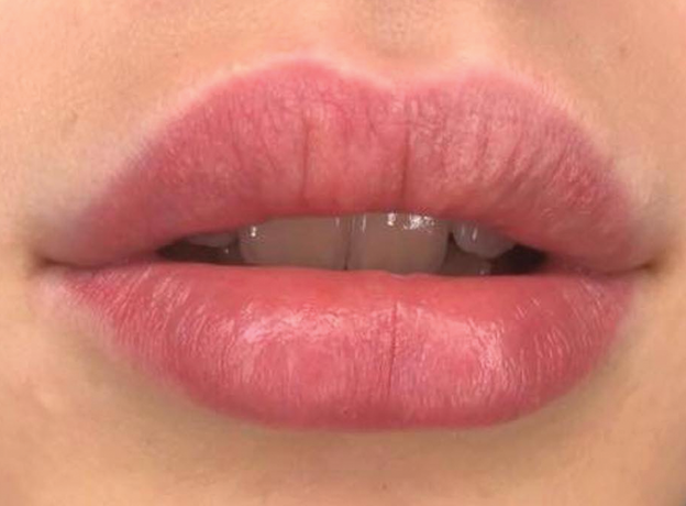 iColor TUNE RED Pigment Buze Micropigmentare 10ml, image , 2 image