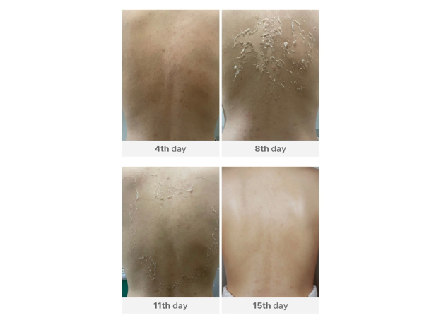 Medisco Peelieve Peeling 1X1g+1X8ml, image , 3 image