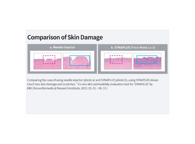 Syna Plus Injector, image , 5 image