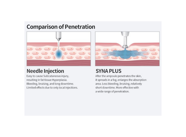 Syna Plus Injector, image , 6 image
