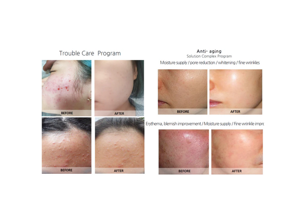 Syna Plus Injector, image , 8 image