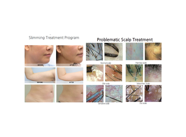 Syna Plus Injector, image , 9 image